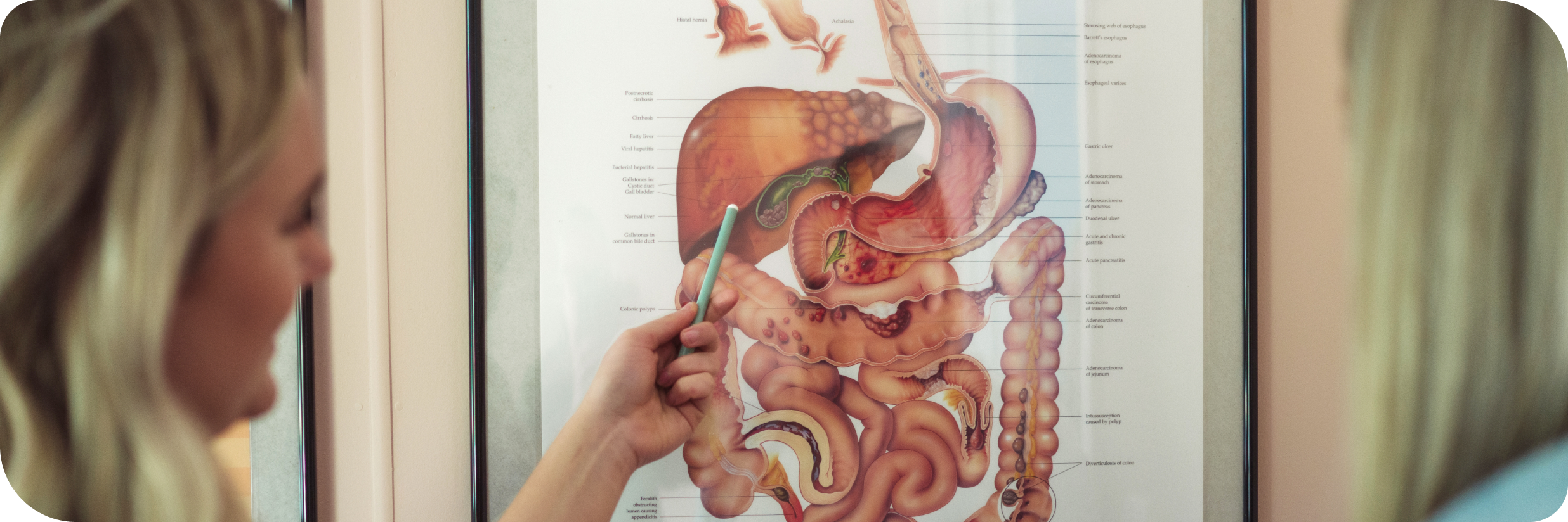 Instructor teaching anatomy with digestive system diagram